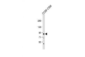 Western Blot at 1:2000 dilution + CCRF-CEM whole cell lysate Lysates/proteins at 20 ug per lane. (MDM2 antibody  (AA 141-176))