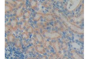 DAB staining on IHC-P; Samples: Rat Kidney Tissue (DGKG antibody  (AA 287-524))