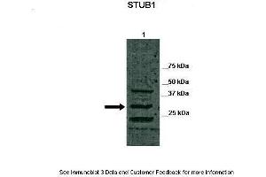 Lanes:   Lane 1: 40ug canine retina lysate  Primary Antibody Dilution:   1:1000  Secondary Antibody:   Goat anti-rabbit-HRP  Secondary Antibody Dilution:   1:5000  Gene Name:   STUB1  Submitted by:   Dr. (STUB1 antibody  (C-Term))