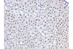 Immunohistochemistry (IHC) image for anti-Forkhead Box A1 (FOXA1) (AA 372-472) antibody (ABIN6939650)