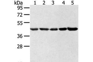 Western blot analysis of Hela lncap NIH/3T3 K562 and 231 cell using WDR77 Polyclonal Antibody at dilution of 1:500 (WDR77 antibody)