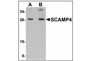 Western blot analysis of SCAMP4 in 3T3 cell lysate with SCAMP4 antibody at (A) 1 and (B) 2 µg/ml.