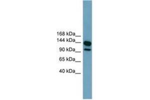 Image no. 1 for anti-Leucine Rich Repeat Containing 66 (LRRC66) (AA 575-624) antibody (ABIN6744784) (LRRC66 antibody  (AA 575-624))