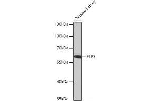 Western blot analysis of extracts of Mouse kidney using ELP3 Polyclonal Antibody at dilution of 1:1000. (ELP3/KAT9 antibody)