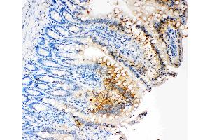 IHC analysis of Caspase-3 (P17)using anti- Caspase-3 (P17)antibody . (Caspase 3 antibody  (N-Term))