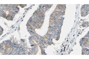 ABIN6276563 at 1/100 staining Human prostate tissue by IHC-P. (ACTN1 antibody  (N-Term))