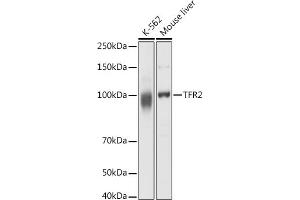 Western blot analysis of extracts of various cell lines, using TFR2 antibody (ABIN6128863, ABIN6149063, ABIN6149064 and ABIN6225172) at 1:1000 dilution. (Transferrin Receptor 2 antibody  (AA 582-801))