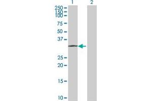 Western Blot analysis of PPT1 expression in transfected 293T cell line by PPT1 MaxPab polyclonal antibody. (PPT1 antibody  (AA 1-306))