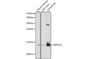 Western blot analysis of extracts of various cell lines, using MRPL51 antibody (ABIN7268577) at 1:1000 dilution. (MRPL51 antibody  (AA 1-128))