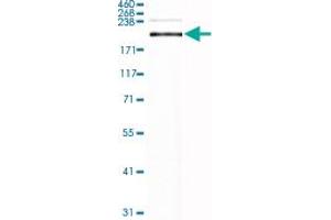 Western Blot analysis of human lung tissue lysate with LAMB2 monoclonal antibody, clone CL2976 .