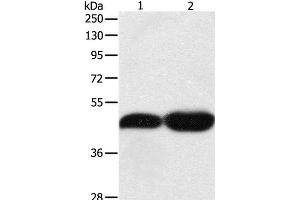 Western Blot analysis of NIH/3T3 and Lncap cell using TEKT1 Polyclonal Antibody at dilution of 1:500 (TEKT1 antibody)