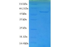 SDS-PAGE (SDS) image for ERGIC and Golgi 3 (ERGIC3) (AA 47-341) protein (His-SUMO Tag) (ABIN5711993)