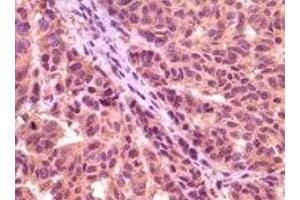 Immunohistochemistry (IHC) image for anti-Glycogen Synthase Kinase 3 alpha (GSK3a) (truncated) antibody (ABIN2464059) (GSK3 alpha antibody  (truncated))