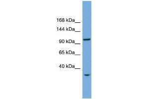 WB Suggested Anti-CHTF18 Antibody Titration: 0. (CTF18 antibody  (Middle Region))