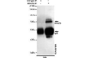 Immunoprecipitation analysis of Hela cell lysates using R mouse mAb. (RPA1 antibody)