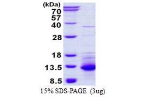 SDS-PAGE (SDS) image for Chemokine (C-X-C Motif) Ligand 11 (CXCL11) (AA 22-94) protein (His tag) (ABIN666799)