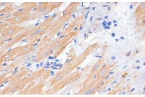 Immunohistochemistry of paraffin-embedded Rat heart using PDCD2L Polyclonal Antibody at dilution of 1:100 (40x lens). (PDCD2L antibody)