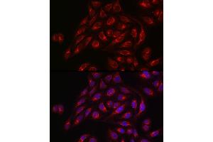 Immunofluorescence analysis of U2OS cells using TLR1 Rabbit pAb (ABIN3023654, ABIN3023655, ABIN3023656 and ABIN6214092) at dilution of 1:50 (40x lens). (TLR1 antibody  (AA 30-290))