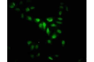 Immunofluorescence staining of Hela cells with ABIN7158992 at 1: 266, counter-stained with DAPI. (MAPKAP Kinase 5 antibody  (AA 200-471))