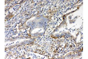 IHC analysis of CD151 using anti- CD151 antibody . (CD151 antibody  (AA 113-175))