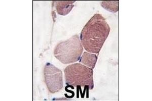 Formalin-fixed and paraffin-embedded human skeletal muscle tissue reacted with UCHL3 Antibody (C-term) (ABIN1882147 and ABIN2839167) , which was peroxidase-conjugated to the secondary antibody, followed by DAB staining. (UCHL3 antibody  (C-Term))