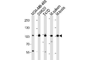 Western Blotting (WB) image for anti-Enhancer of Zeste Homolog 2 (EZH2) (AA 1-296), (N-Term) antibody (ABIN650707)