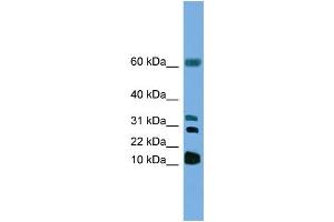 WB Suggested Antibody Titration: 1 ug/ml Positive Control: HepG2