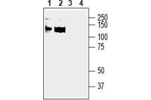 Western blot analysis of human THP-1 monocytic leukemia cell line lysate (lanes 1 and 3) and human MEG-01 megakaryoblastic leukemia cell line lysate (lanes 2 and 4): - 1,2. (Anoctamin 6 antibody  (2nd Extracellular Loop))