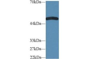 Western Blot; Sample: Rat Cerebrum lysate; Primary Ab: 2µg/ml Rabbit Anti-Mouse TNFRSF19L Antibody Second Ab: 0. (RELT antibody  (AA 222-363))