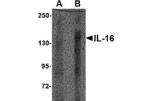 Western Blotting (WB) image for anti-Interleukin 16 (IL16) (N-Term) antibody (ABIN1031693) (IL16 antibody  (N-Term))