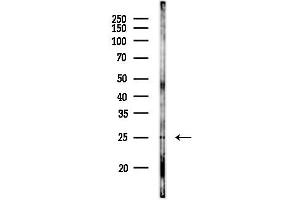 anti-Claudin 19 (CLDN19) (Internal Region) antibody