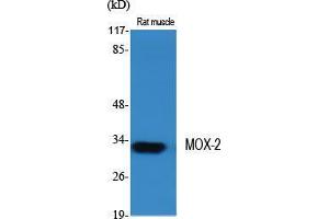 Western Blot (WB) analysis of specific cells using MOX-2 Polyclonal Antibody. (NOX3 antibody  (Internal Region))