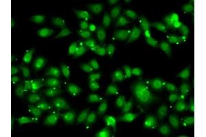 Immunofluorescence analysis of MCF7 cells using NR2C1 antibody (ABIN6128389, ABIN6144809, ABIN6144810 and ABIN6222379). (NR2C1 antibody  (AA 1-240))