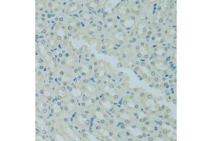 Immunohistochemistry of paraffin-embedded mouse kidney using MBD2 antibody. (MBD2 antibody)