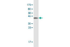 Western Blot detection against Immunogen (35. (TJP3 antibody  (AA 868-952))