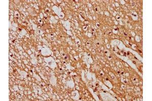 IHC image of ABIN7165614 diluted at 1:400 and staining in paraffin-embedded human brain tissue performed on a Leica BondTM system.