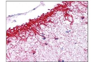 Human Brain, Cortex: Formalin-Fixed, Paraffin-Embedded (FFPE) (NLRP14 antibody  (N-Term))