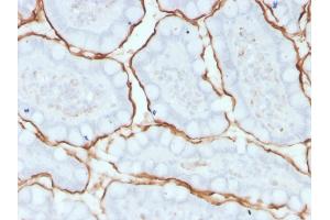 Formalin-fixed, paraffin-embedded human small intestine stained with ACE / CD143 Mouse Monoclonal Antibody (9B9). (Angiotensin I Converting Enzyme 1 antibody)
