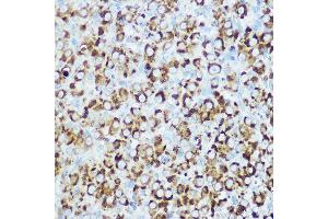 Immunohistochemistry of paraffin-embedded rat ovary using RSPO1 Rabbit pAb (ABIN6132958, ABIN6147279, ABIN6147280 and ABIN6224304) at dilution of 1:100 (40x lens). (RSPO1 antibody  (AA 21-263))