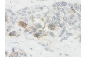 Image no. 2 for anti-Nephroblastoma Overexpressed (NOV) antibody (ABIN465355) (NOV antibody)