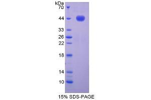 SDS-PAGE analysis of Mouse Noggin Protein.
