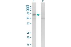 Western Blot analysis of KCNQ5 expression in transfected 293T cell line by KCNQ5 monoclonal antibody (M01), clone 2E2. (KCNQ5 antibody  (AA 833-932))