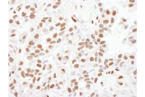 Immunohistochemistry (IHC) image for anti-Tumor Protein P53 Binding Protein 1 (TP53BP1) (AA 350-400) antibody (ABIN7454500)