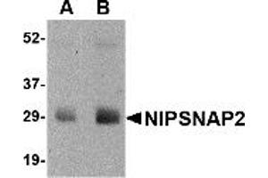 Western Blotting (WB) image for anti-Glioblastoma Amplified Sequence (GBAS) (N-Term) antibody (ABIN1031480) (GBAS antibody  (N-Term))