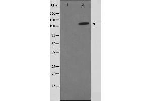Western blot analysis on HuvEc cell lysate using FIR Antibody,The lane on the left is treated with the antigen-specific peptide. (FARP2 antibody  (Internal Region))