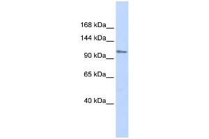 WB Suggested Anti-ZFPM1 Antibody Titration:  0. (ZFPM1 antibody  (Middle Region))