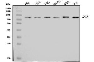 Western blot analysis of CENPB using anti-CENPB antibody (ABIN7602867).