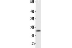 Anti-GM-CSF Picoband antibody, All lanes: Anti-GM-CSF at 0. (GM-CSF antibody  (AA 18-141))