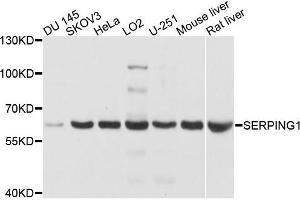 Western blot analysis of extracts of various cells, using SERPING1 antibody. (SERPING1 antibody)