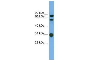 WB Suggested Anti-SH3KBP1 Antibody Titration: 0. (SH3KBP1 antibody  (N-Term))